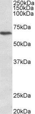 Western Blot: CACNB2 Antibody [NBP2-11566] (1ug/ml) staining of Jurkat lysate (35ug protein in RIPA buffer). Primary incubation was 1 hour. Detected by chemiluminescence.