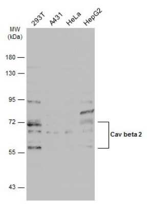 Western Blot: CACNB2 Antibody [NBP3-13049] - Various whole cell extracts (30 ug) was separated by 7.5% SDS-PAGE, and the membrane was blotted with CACNB2 antibody (NBP3-13049) diluted at 1:1000. The HRP-conjugated anti-rabbit IgG antibody (NBP2-19301) was used to detect the primary antibody.