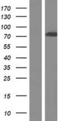 Western Blot CACNB2 Overexpression Lysate