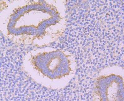 Immunohistochemistry: CACNB3 Antibody [NBP2-76916] - Immunohistochemical analysis of paraffin-embedded human uterus tissue using anti-CACNB3 antibody. Counter stained with hematoxylin.
