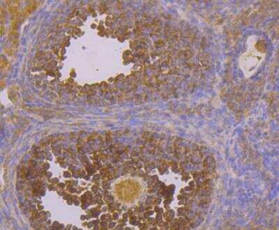Immunohistochemistry: CACNB3 Antibody [NBP2-76916] - Immunohistochemical analysis of paraffin-embedded mouse ovary tissue using anti-CACNB3 antibody. Counter stained with hematoxylin.