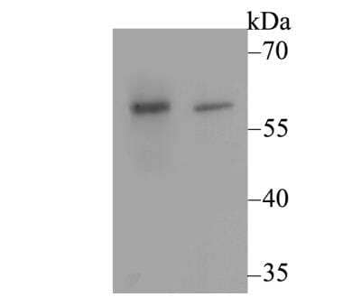 Western Blot: CACNB3 Antibody [NBP2-76916] - Western blot analysis of CACNB3 on different lysates using anti-CACNB3 antibody at 1/500 dilution.Positive control:Lane1: Rat brain tissueLane2: SKOV-3