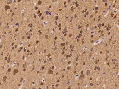 Immunohistochemistry-Paraffin: CACNB4 Antibody [NBP2-98196] - Immunochemical staining of human CACNB4 in human brain with rabbit polyclonal antibody at 1:100 dilution, formalin-fixed paraffin embedded sections.