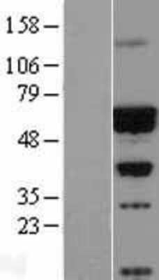 Western Blot: CACNB4 Overexpression Lysate (Adult Normal) [NBL1-08630] Left-Empty vector transfected control cell lysate (HEK293 cell lysate); Right -Over-expression Lysate for CACNB4.