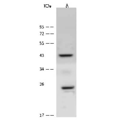 Western Blot: CACNG1 Antibody [NBP2-99567] - Anti-CACNG1 rabbit polyclonal antibody at 1:500 dilution. Lane A: A549 Whole Cell Lysate. Lane B: Jurkat Whole Cell Lysate. Lane C: HeLa Whole Cell Lysate. Lane D: A431 Whole Cell Lysate. Lysates/proteins at 30 ug per lane. Secondary Goat Anti-Rabbit IgG (H+L)/HRP at 1/10000 dilution. Developed using the ECL technique. Performed under reducing conditions. Predicted band size: 27 kDa. Observed band size: 27 kDa