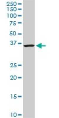 Western Blot: CACNG3 Antibody (3E4) [H00010368-M01] - CACNG3 monoclonal antibody (M01), clone 3E4. Analysis of CACNG3 expression in PC-12.