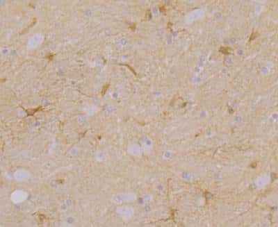 Immunohistochemistry: CACNG3 Antibody [NBP2-76918] - Immunohistochemical analysis of paraffin-embedded rat brain tissue using anti-CACNG3 antibody. Counter stained with hematoxylin.