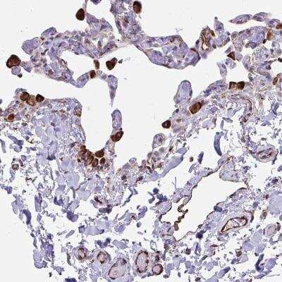 Immunohistochemistry-Paraffin: CACNG3 Antibody [NBP2-31738] - Staining of human lung shows strong cytoplasmic positivity in macrophages and endothelial cells.