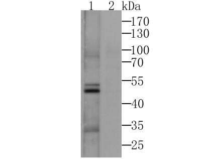 Western Blot: CACNG3 Antibody [NBP2-76918] - Western blot analysis of CACNG3 on SH-SY-5Y cell lysates using anti-CACNG3 antibody.Lane 1: Anti-CACNG3 Antibody (1:500). Lane 2: Anti-CACNG3 Antibody, pre-incubated with the immunizaiton peptide.
