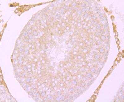 Immunohistochemistry: CACNG4 Antibody [NBP2-76920] - Immunohistochemical analysis of paraffin-embedded rat testis tissue using anti- Cacng4 antibody. Counter stained with hematoxylin.