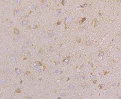 Immunohistochemistry: CACNG4 Antibody [NBP2-76920] - Immunohistochemical analysis of paraffin-embedded rat brain tissue using anti- Cacng4 antibody. Counter stained with hematoxylin.
