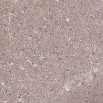 Immunohistochemistry-Paraffin: CACNG4 Antibody [NBP2-55176] - Staining of human cerebral cortex shows high expression.