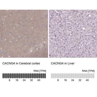 <b>Orthogonal Strategies Validation. </b>Immunohistochemistry-Paraffin: CACNG4 Antibody [NBP2-55176] - Staining in human cerebral cortex and liver tissues using anti-CACNG4 antibody. Corresponding CACNG4 RNA-seq data are presented for the same tissues.