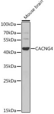 Immunohistochemistry-Paraffin: CACNG4 Antibody [NBP2-92675] - Analysis of extracts of mouse brain, using CACNG4 .Exposure time: 90s.
