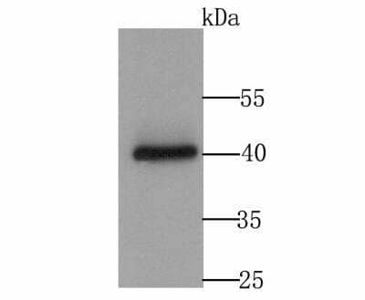 Western Blot: CACNG4 Antibody [NBP2-76920] - Western blot analysis of Cacng4 on MCF-7 cell lysate using anti-Cacng4 antibody at 1/500 dilution.