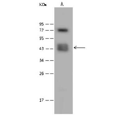 Western Blot: CACNG4 Antibody [NBP2-99568] - Anti-CACNG4 rabbit polyclonal antibody at 1:500 dilution. Lane A: K562 Whole Cell Lysate Lysates/proteins at 30 ug per lane. Secondary Goat Anti-Rabbit IgG (H+L)/HRP at 1/10000 dilution. Developed using the ECL technique. Performed under reducing conditions. Predicted band size: 37 kDa