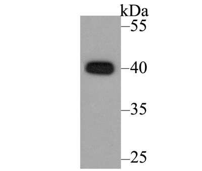 Western Blot: CACNG5 Antibody [NBP2-76921] - Western blot analysis of CACNG5 on LOVO cell lysate using anti-CACNG5 antibody at 1/200 dilution.