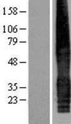 Western Blot: CACNG5 Overexpression Lysate (Adult Normal) [NBP2-05372] Left-Empty vector transfected control cell lysate (HEK293 cell lysate); Right -Over-expression Lysate for CACNG5.