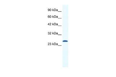 Western Blot CACNG6 Antibody - BSA Free
