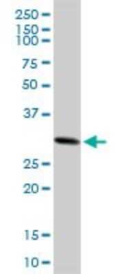Western Blot: CACYBP Antibody [H00027101-B01P] - Analysis of CACYBP expression in HeLa.
