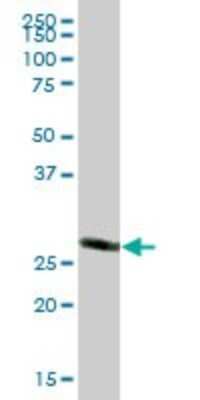 Western Blot: CACYBP Antibody [H00027101-B01P] - Analysis of CACYBP expression in human kidney.