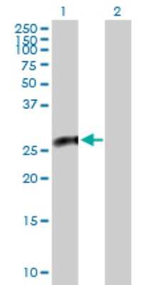 Western Blot: CACYBP Antibody [H00027101-B01P] - Analysis of CACYBP expression in transfected 293T cell line by CACYBP polyclonal antibody.  Lane 1: CACYBP transfected lysate(25.08 KDa). Lane 2: Non-transfected lysate.