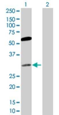 Western Blot: CACYBP Antibody [H00027101-D01P] - Analysis of CACYBP expression in transfected 293T cell line by CACYBP polyclonal antibody.Lane 1: CACYBP transfected lysate(26.20 KDa).Lane 2: Non-transfected lysate.