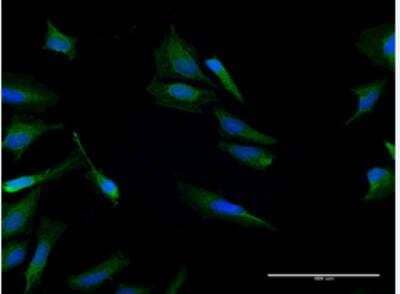 Immunocytochemistry/Immunofluorescence: CALCB Antibody [H00000797-B02P-50ug] - Purified MaxPab antibody to CALCB on HeLa cell. [antibody concentration 10 ug/ml]