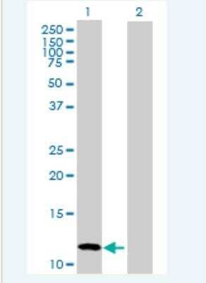 Western Blot: CALCB Antibody [H00000797-B02P-50ug] - Analysis of CALCB expression in transfected 293T cell line (H00000797-T02) by CALCB MaxPab polyclonal antibody.