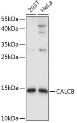 Western Blot: CALCB Antibody [NBP2-92827] - Analysis of extracts of various cell lines, using CALCB at 1:1000 dilution.Secondary antibody: HRP Goat Anti-Rabbit IgG (H+L) at 1:10000 dilution.Lysates/proteins: 25ug per lane.Blocking buffer: 3% nonfat dry milk in TBST.Detection: ECL Basic Kit .Exposure time: 5s.