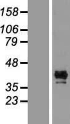 Western Blot: CALHM1 Overexpression Lysate (Adult Normal) [NBP2-08979] Left-Empty vector transfected control cell lysate (HEK293 cell lysate); Right -Over-expression Lysate for CALHM1.