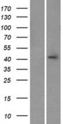 Western Blot: CALHM3 Overexpression Lysate (Adult Normal) [NBP2-09492] Left-Empty vector transfected control cell lysate (HEK293 cell lysate); Right -Over-expression Lysate for CALHM3.