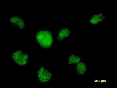 Immunocytochemistry/Immunofluorescence: CALML3 Antibody [H00000810-B02P] - Analysis of purified antibody to CALML3 on HeLa cell. (antibody concentration 10 ug/ml)