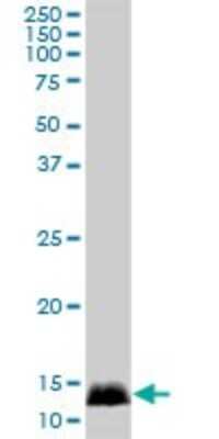 Western Blot: CALML3 Antibody [H00000810-B02P] - Analysis of CALML3 expression in A-431.