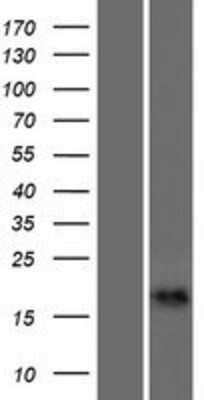 Western Blot: CALML6 Overexpression Lysate (Adult Normal) [NBP2-05641] Left-Empty vector transfected control cell lysate (HEK293 cell lysate); Right -Over-expression Lysate for CALML6.