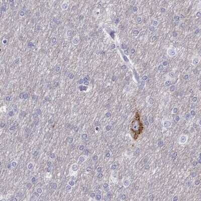 Immunohistochemistry-Paraffin: CALY Antibody [NBP1-91225] - Staining of human cerebral cortex shows high expression.