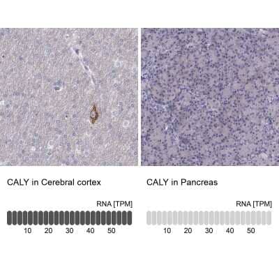 Immunohistochemistry-Paraffin CALY Antibody - BSA Free