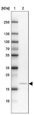 <b>Orthogonal Strategies Validation. </b>Western Blot: CALY Antibody [NBP1-91225] - Lane 1: Marker [kDa] 250, 130, 100, 70, 55, 35, 25, 15, 10Lane 2: Human Cerebral Cortex tissue