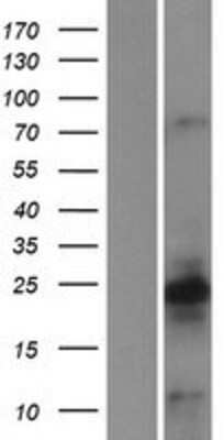 Western Blot: CALY Overexpression Lysate (Adult Normal) [NBP2-07122] Left-Empty vector transfected control cell lysate (HEK293 cell lysate); Right -Over-expression Lysate for CALY.