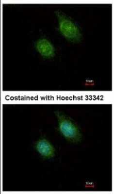 Immunocytochemistry/ Immunofluorescence CAMKID Antibody - BSA Free
