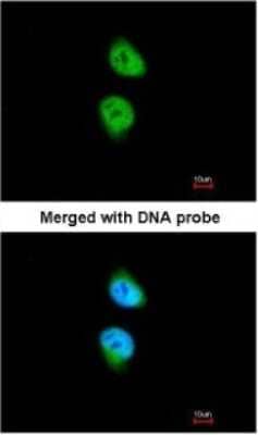 Immunocytochemistry/Immunofluorescence: CAMKID Antibody [NBP1-32831] - Analysis of paraformaldehyde-fixed HeLa, using CAMK1D antibody at 1:200 dilution.