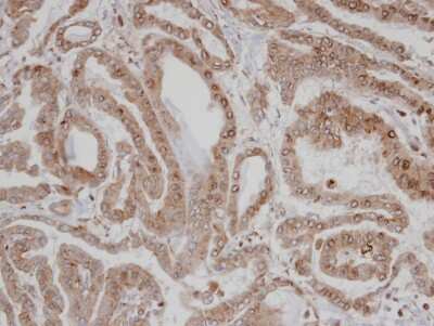 Immunohistochemistry-Paraffin CAMKID Antibody - BSA Free