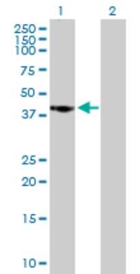 Western Blot: CAMKID Antibody [H00057118-B01P] - Analysis of CAMK1D expression in transfected 293T cell line by CAMK1D polyclonal antibody.  Lane 1: CAMK1D transfected lysate(42.35 KDa). Lane 2: Non-transfected lysate.