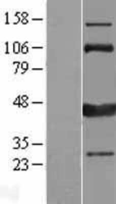 Western Blot CAMKID Overexpression Lysate