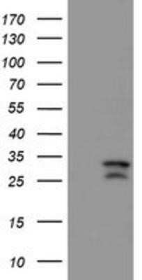 Western Blot: CAMLG Antibody (OTI1A3) - Azide and BSA Free [NBP2-70331] - HEK293T cells were transfected with the pCMV6-ENTRY control (Left lane) or pCMV6-ENTRY CAMLG (Right lane) cDNA for 48 hrs and lysed. Equivalent amounts of cell lysates (5 ug per lane) were separated by SDS-PAGE and immunoblotted with anti-CAMLG.
