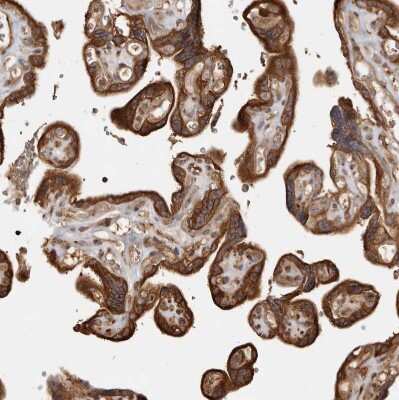 Immunohistochemistry-Paraffin: CAMSAP1L1 Antibody [NBP1-82933] - Staining of human placenta shows strong cytoplasmic positivity in trophoblastic cells.