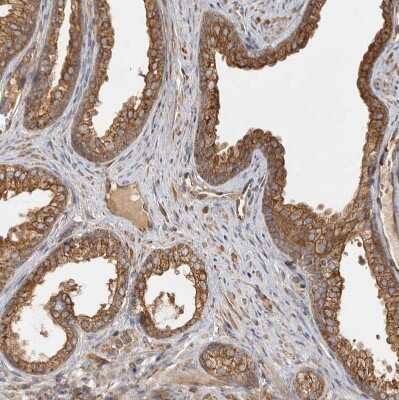 Immunohistochemistry-Paraffin: CAMSAP1L1 Antibody [NBP1-82933] - Staining of human prostate shows moderate cytoplasmic positivity in glandular cells.