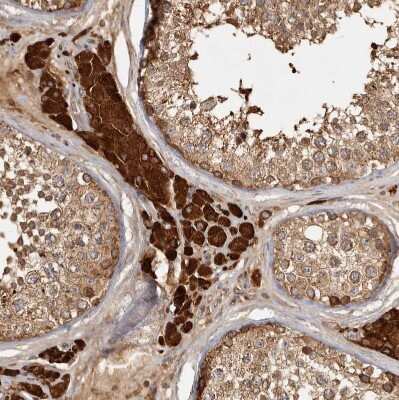 Immunohistochemistry-Paraffin: CAMSAP1L1 Antibody [NBP1-82933] - Staining of human testis shows strong cytoplasmic positivity in Leydig cells.