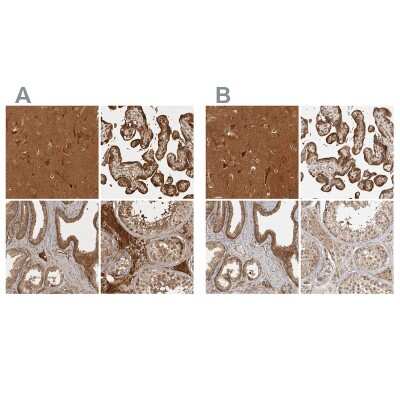 <b>Independent Antibodies Validation. </b>Immunohistochemistry-Paraffin: CAMSAP1L1 Antibody [NBP1-82934] - Staining of human cerebral cortex, placenta, prostate and testis using Anti-CAMSAP2 antibody NBP1-82934 (A) shows similar protein distribution across tissues to independent antibody NBP1-82935 (B).