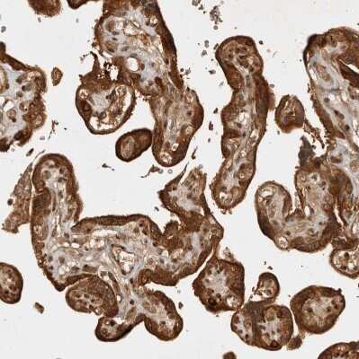 Immunohistochemistry-Paraffin: CAMSAP1L1 Antibody [NBP1-82934] - Staining of human placenta shows strong cytoplasmic positivity in trophoblastic cells.